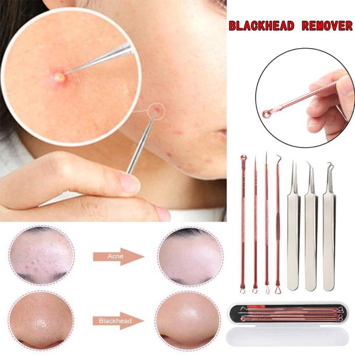 Blackhead Treatment Tool set 4pcs Cleaning Tools set